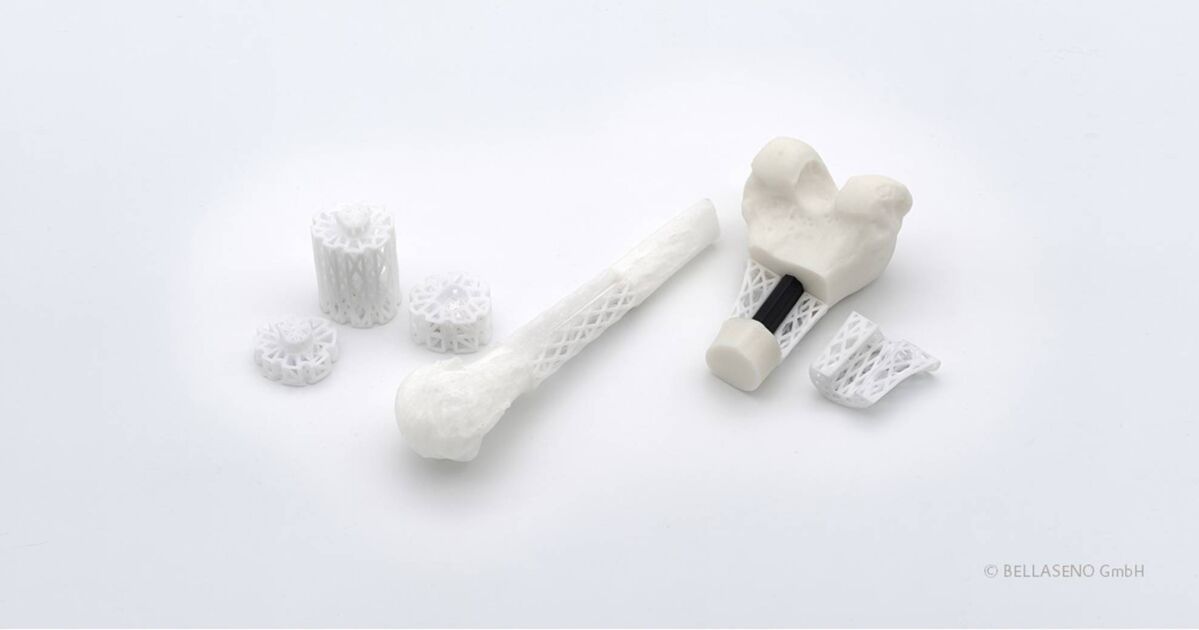 Evonik And BellaSeno Advance Commercialization Of 3D-printed ...